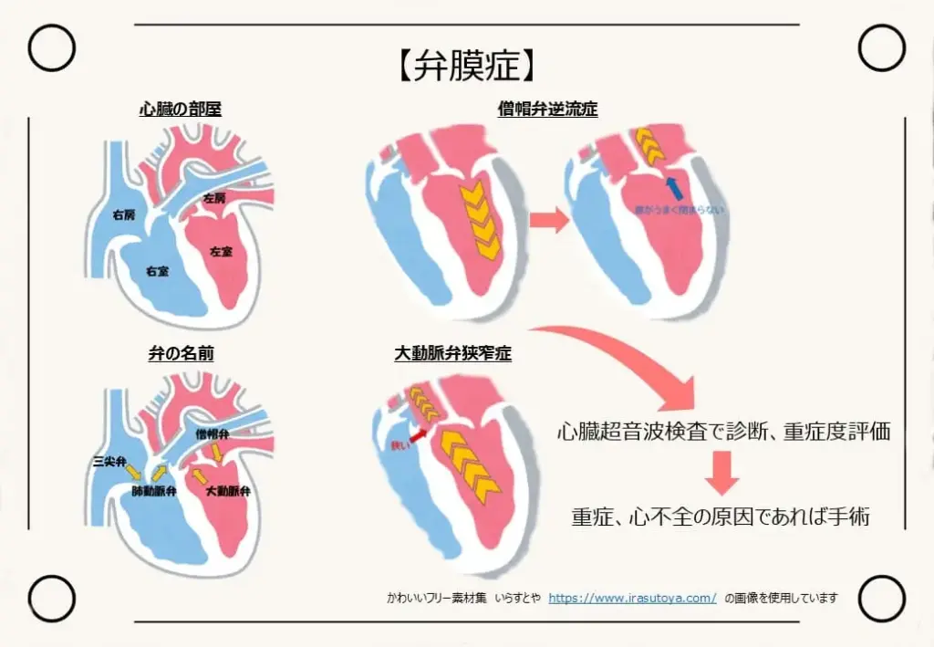 弁膜症