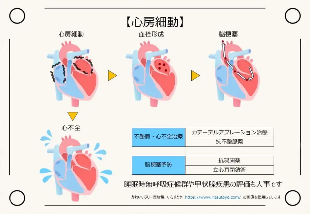 心房細動